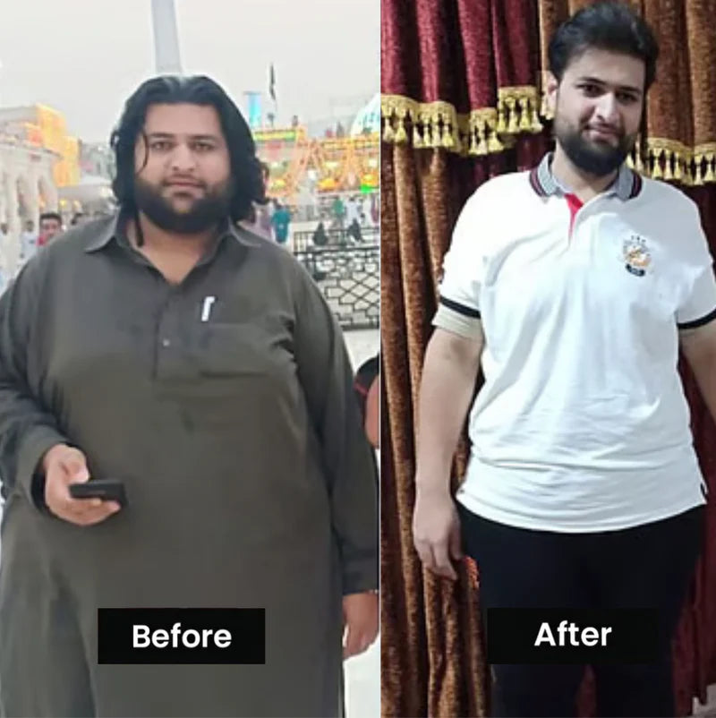 Before & After transformation 1